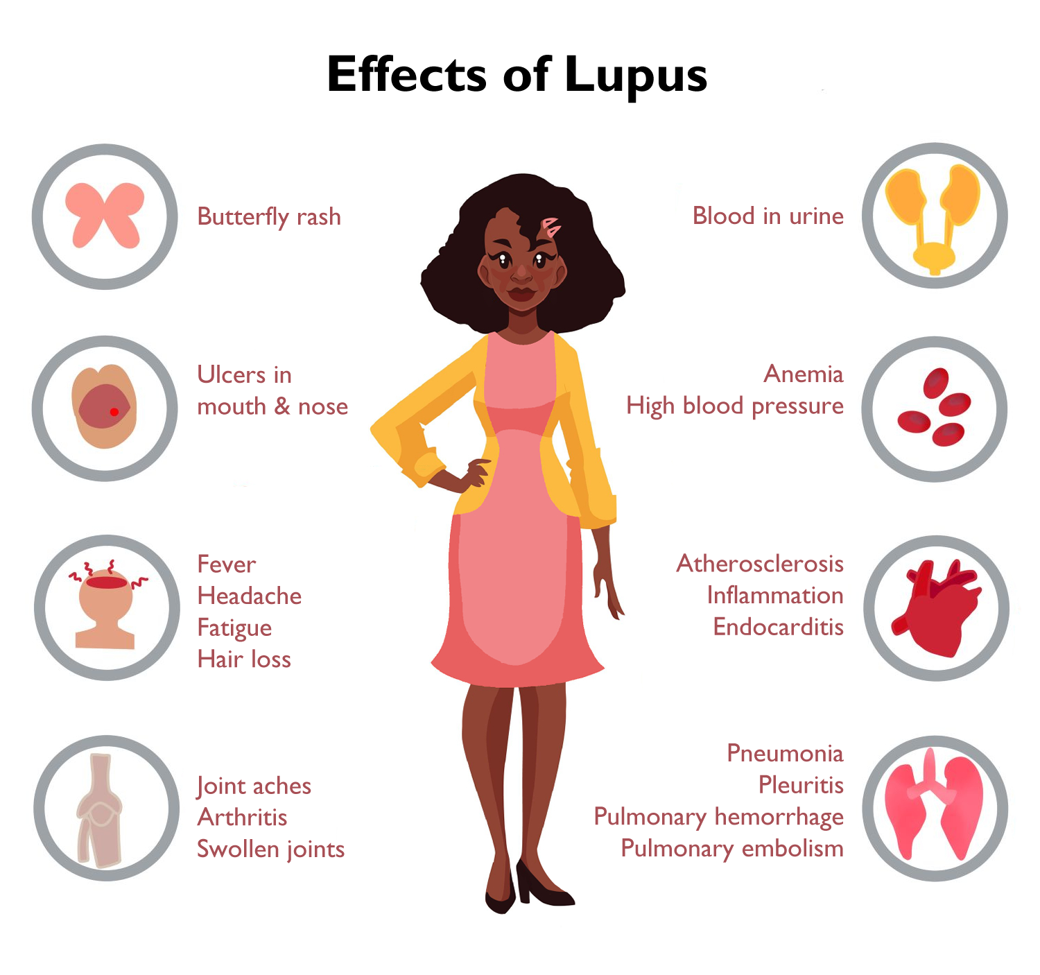 effects of lupus